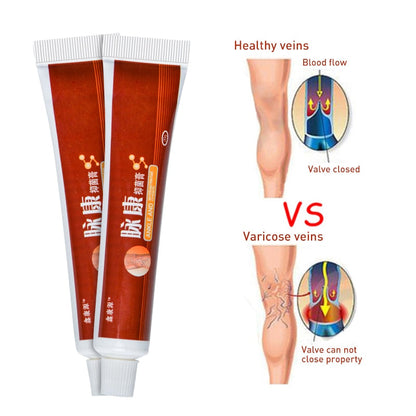 Varicose Veins Miracle Cream (Original Product)