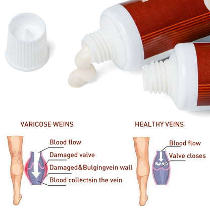 Varicose Veins Miracle Cream (Original Product)