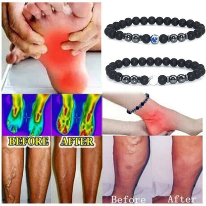 Anti Varicose And Swelling Magnetotherapy Anklet