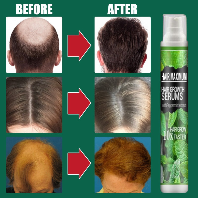 Hair-Growth Essence Spray